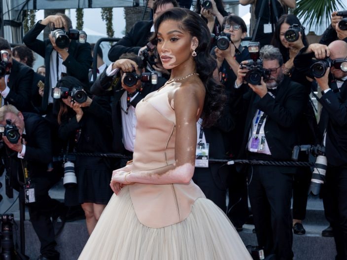 Winnie Harlow